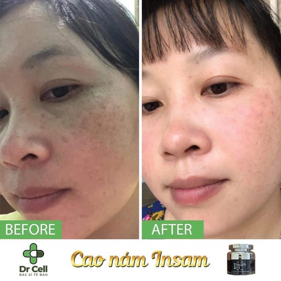 Cao Nám Insam Dr Cell 20g mờ thâm nám tàn nhang trắng da trẻ hoá da