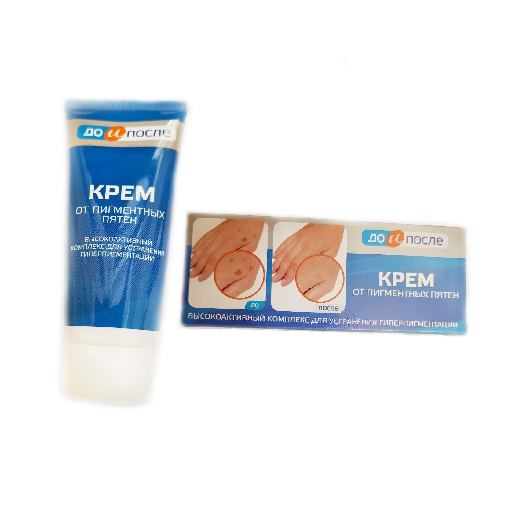 [HCM]Kem Loại Bỏ Đồi Mồi Da Tay Chân Kpem 50ml