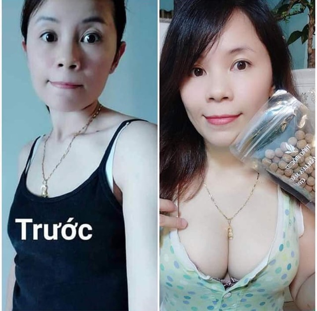 Kẹo mầm lúa mạch GOLD Thảo Mộc 37