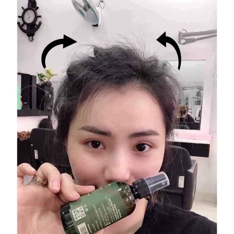 [ Vi Jully ] Combo 5 Chai Tinh Dầu Bưởi Vi Jully Kích Mọc Tóc - Làm Dài Tóc Nhanh