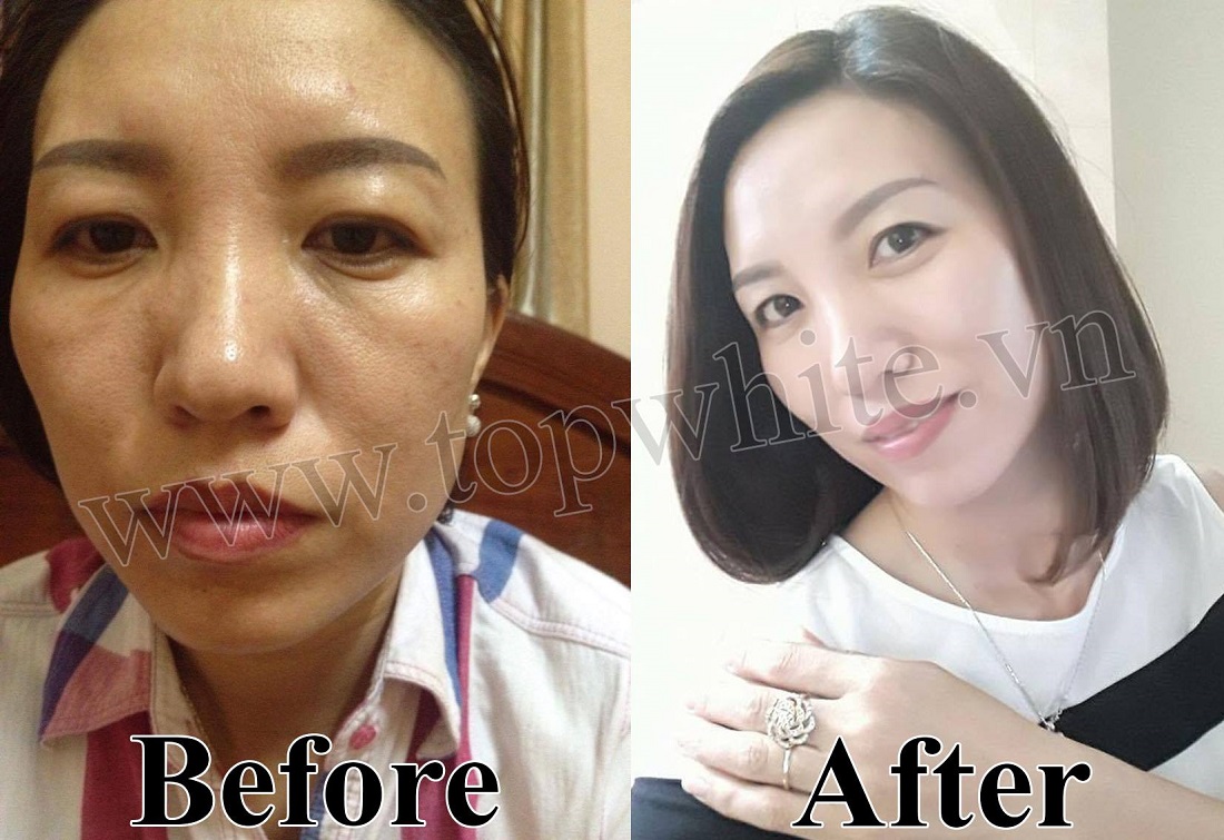 Kem Dưỡng Da Ban Đêm Top White D2