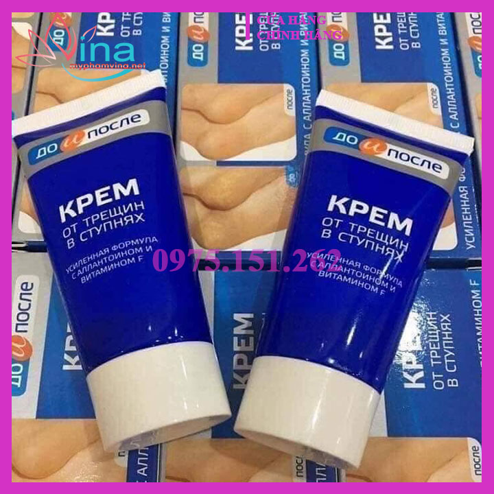KEM NỨT GÓT CHÂN KPEM 50ML - NGA