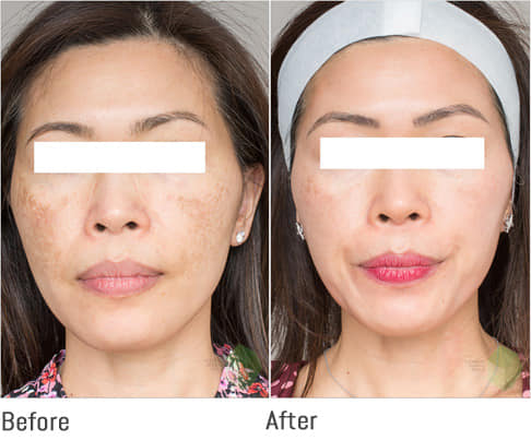 Kem Chống Nắng Eucerin Sun Serum Double Whitening SPF50