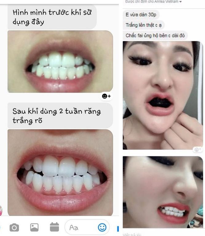 [Miếng lẻ] Miếng Dán Trắng Răng Anriea Black Tooth Whitening - 30 Minutes Express