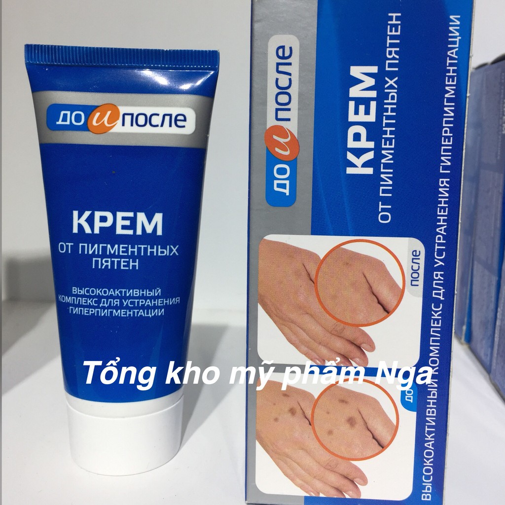 [HCM]Kem đồi mồi tay chân kpem