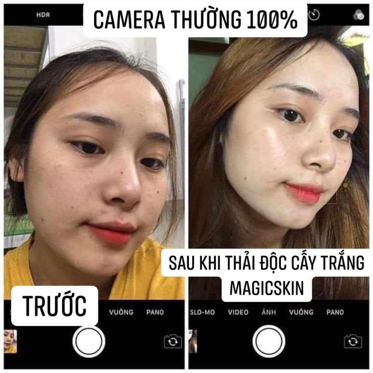 Nạ ủ yến thải độc Magic Skin