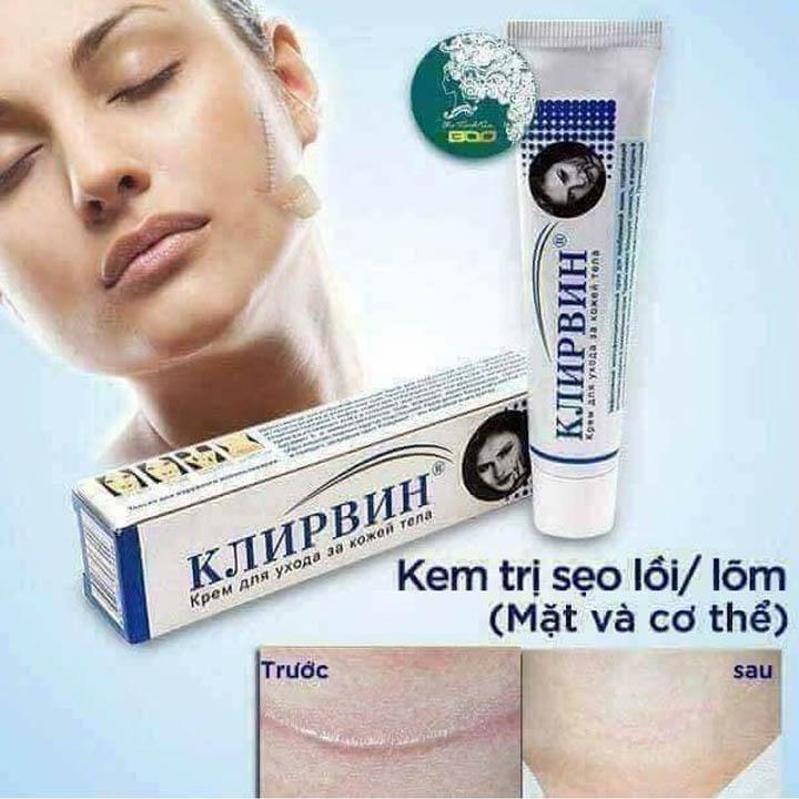 Kem Trị Seo Cao Cấp Nga