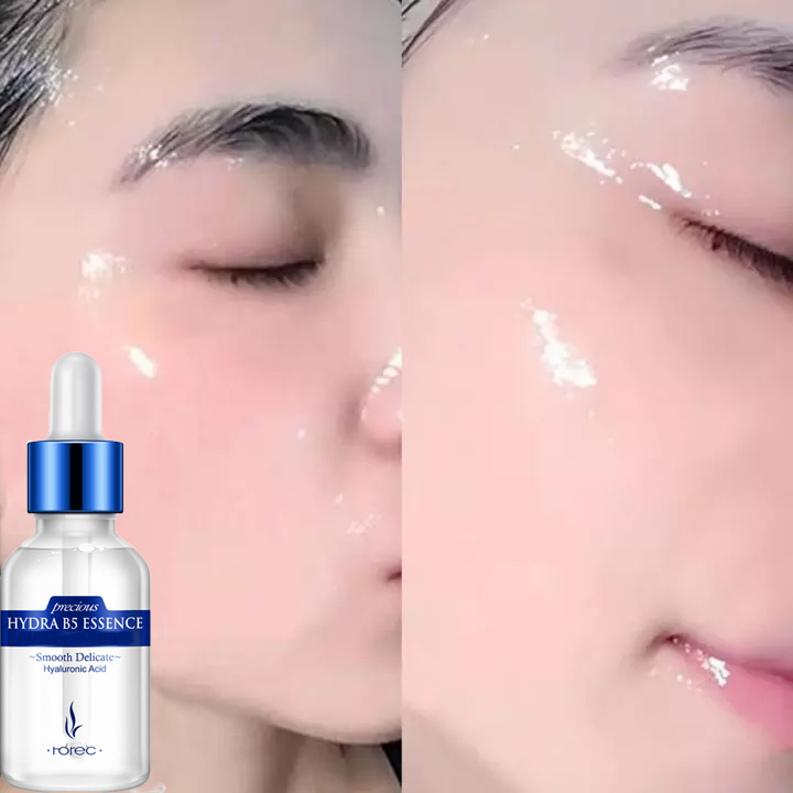 Serum dưỡng ẩm da Hydra B5 rorec