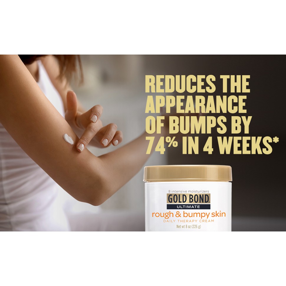 KEM DƯỠNG DA GOLD BOND ULTIMATE ROUGH & BUMPY SKIN 226G