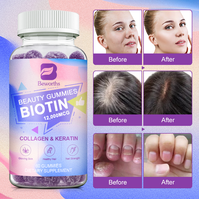 BEWORTHS Biotin Gummies 12000mcg với Biotin, Collagen, Keratin, Chất diệp lục, Kẽm và Vitamin A, B6, B12, C, D, E Hỗ trợ sự phát triển của da và móng cho phụ nữ và nam giới