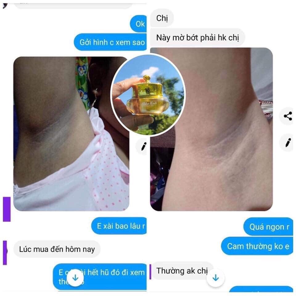 [HCM][HÀNG CHÍNH HÃNG] Kem Siêu Dưỡng Thâm 5S Biho Ladi