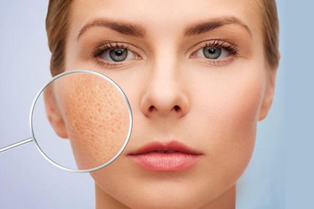 Tế Bào Gốc Giảm Sẹo 5Gf