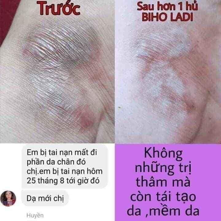 [HCM][HÀNG CHÍNH HÃNG] Kem Siêu Dưỡng Thâm 5S Biho Ladi