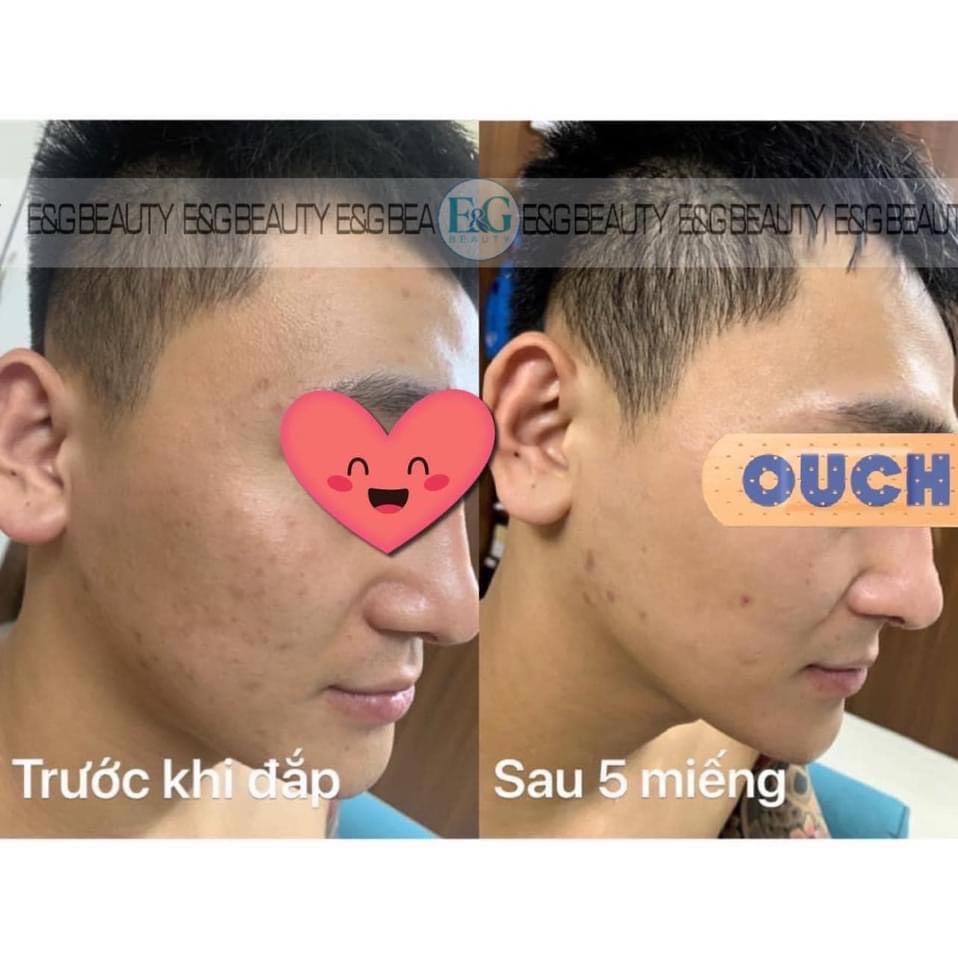 Mặt nạ RETINOL E&G trắng da trẻ hóa làn da