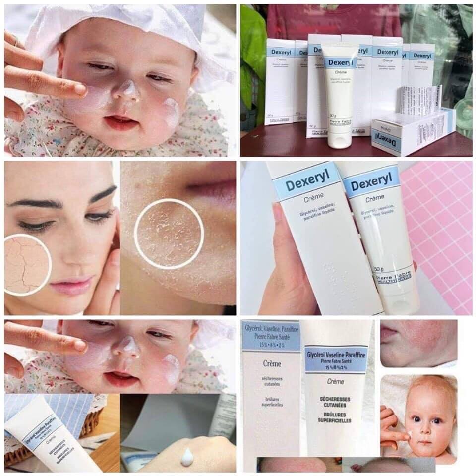 Kem nẻ Dexeryl bé Babymall.vn