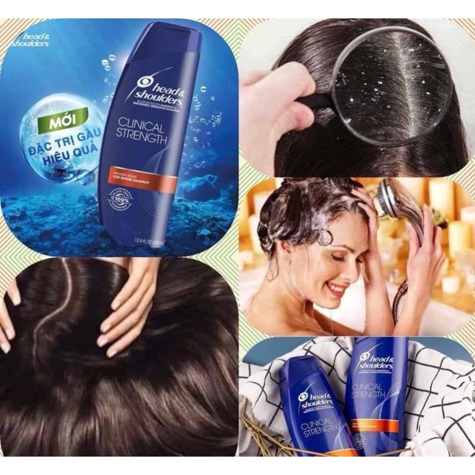 Dầu gội đầu Head&Shoulders Clinical Strength Shampoo 400ml