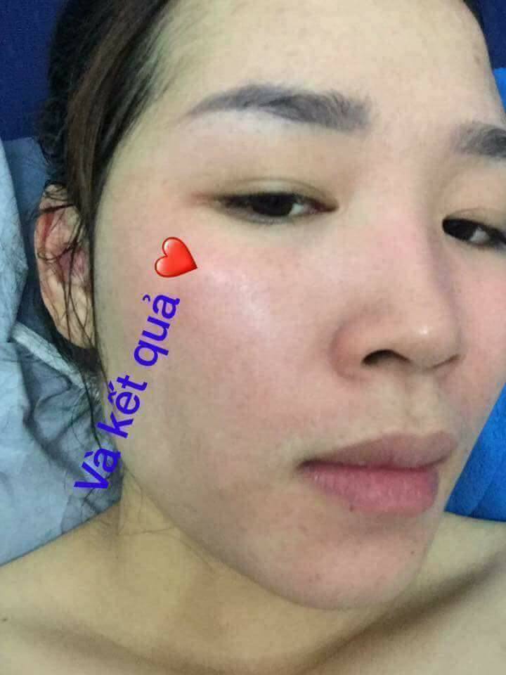 [HCM]BÁN CHẠY - KEM FACE TUYẾT SỨ MOCHA