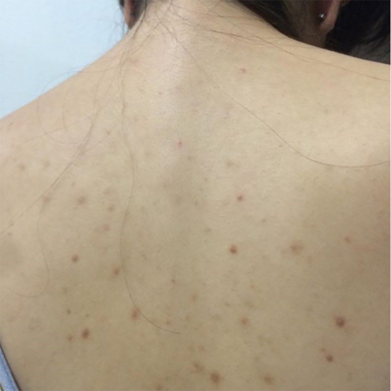 [HCM]Xịt Mụn Cơ Thể The Magic Clear Body Mist Hàn Quốc