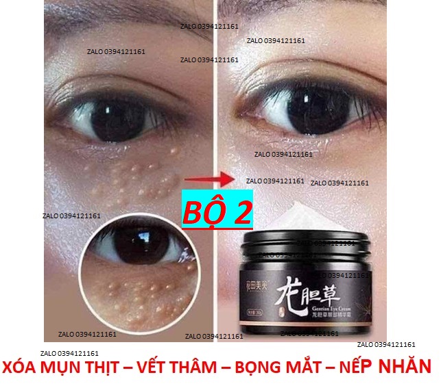 2HỘP XÓA MỤN THỊT - BỌNG MẮT - ĐÁNH BAY QUẦNG THÂM QUANH MẮT - SÁT MẮT - LÀM MỜ VẾT NHĂN - MỊN DA - 1A1 OK [ NHIỀU LƯỢT TRUY CẬP ] hxmt 1.11