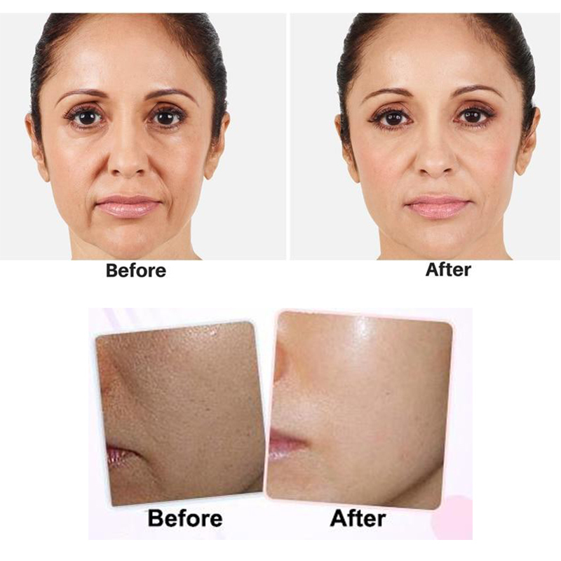 [HCM]Tinh Chất Giảm mụn The Ordinary Salicylic Acid 2% Solution