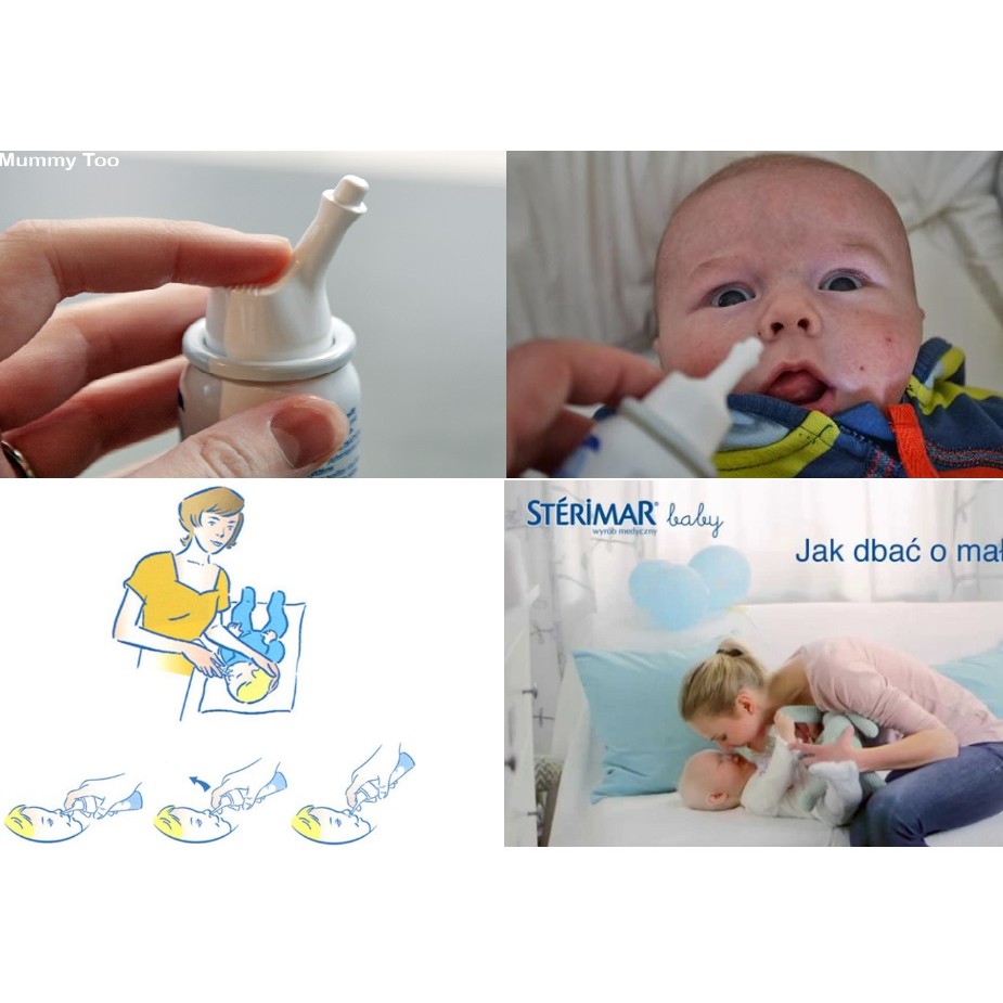[HCM] Xịt cá heo muối biển Sterimar cá heo Pháp 100ml.
