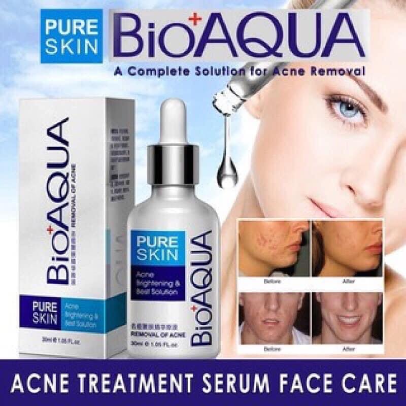 Serum Xóa Mụn Bioaqua 30ml