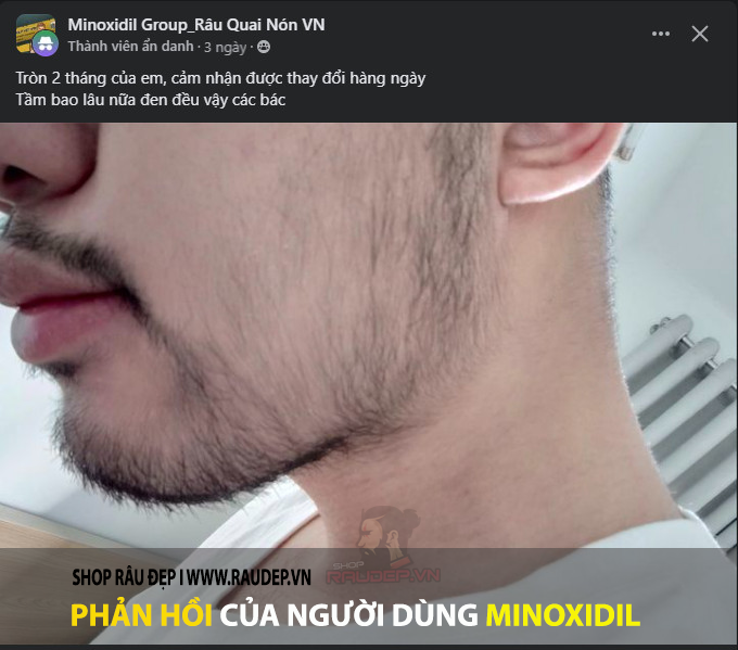 (MẪU MỚI) Minoxidil 5% Mọc Râu Tóc Dạng Bọt Không Gây Dị Ứng Da (Minoxidil 5% Foam)
