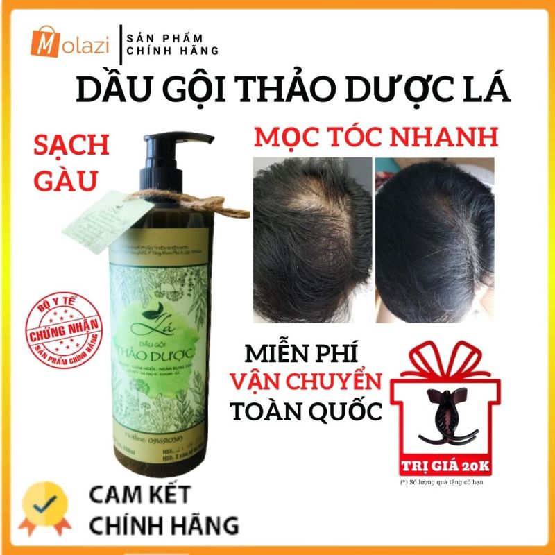 Top 10 Sản phẩm dầu gội kích thích mọc tóc hiệu quả nhất - toplist.vn