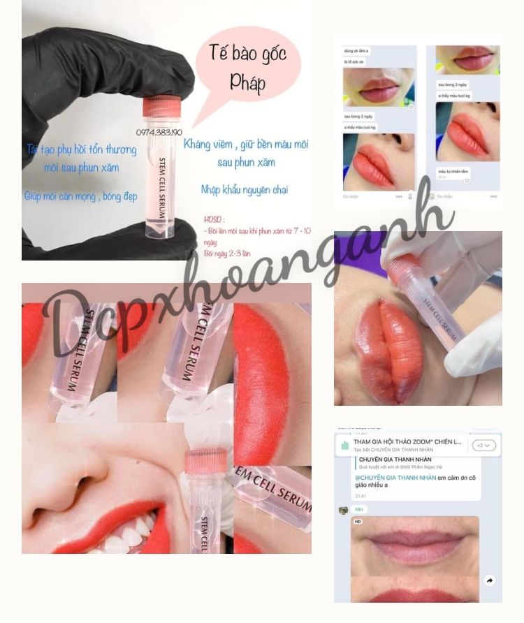 Dưỡng Tế Bào Gốc Stem Cell Serum - Dcpxhoanganh