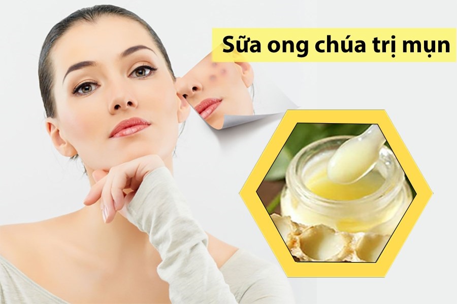 SỮA ONG CHÚA TƯƠI NGUYÊN CHẤT 100GRAM