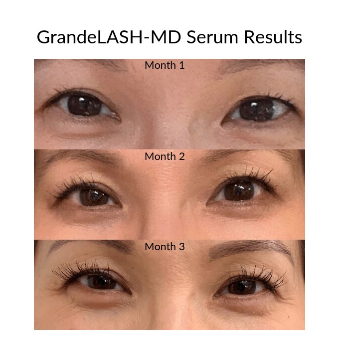 GrandeLash MD ✨ Serum dưỡng dài mi Lash Enhancing Serum