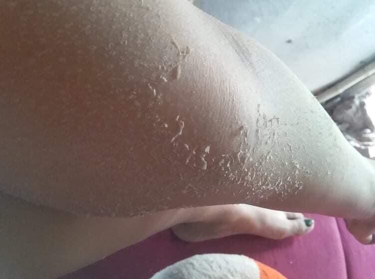 kem bong tái tạo da body