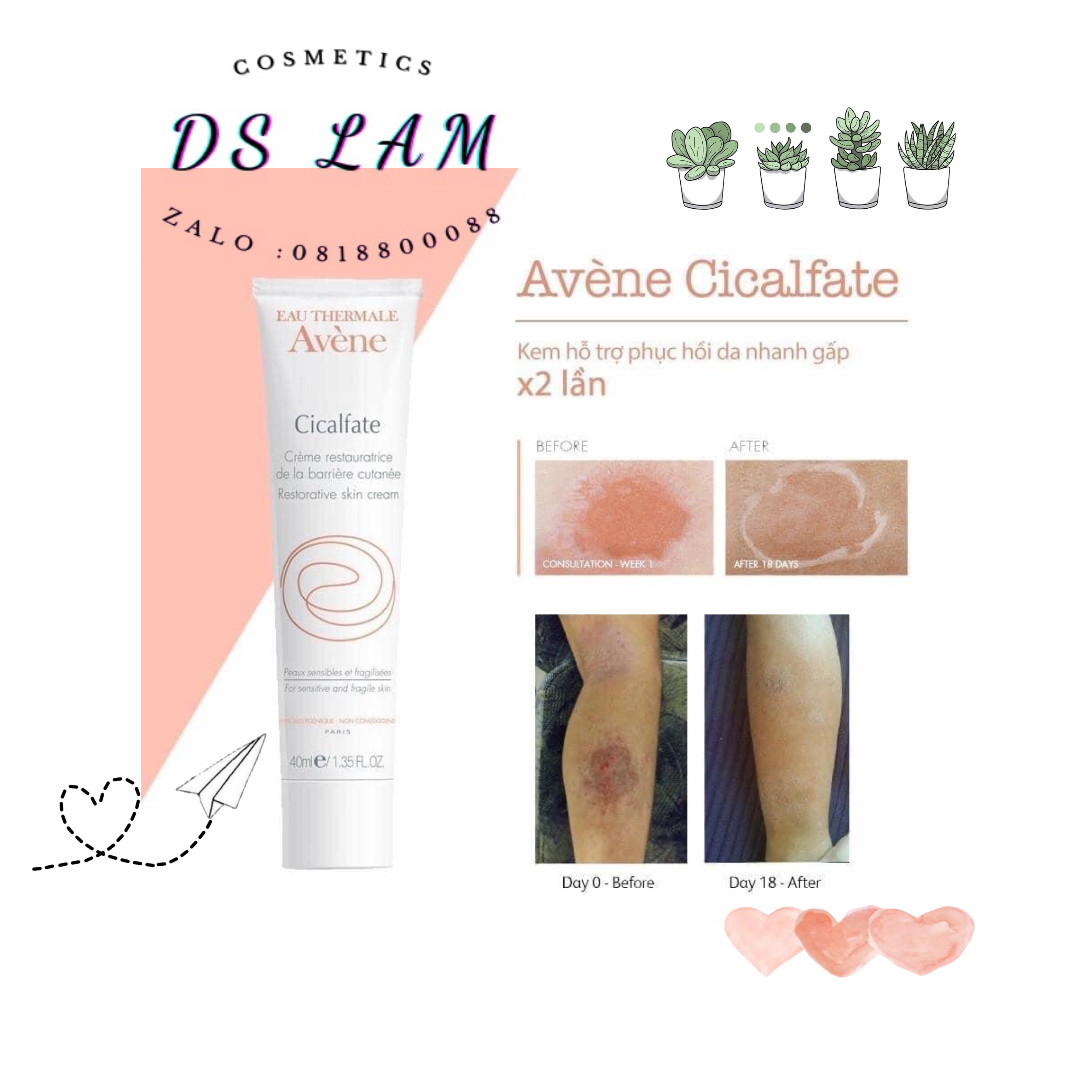 Kem dưỡng ẩm phục hồi da Evene 100ml