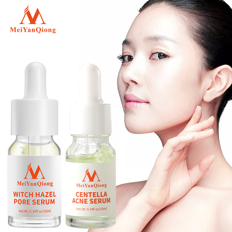 MeiYanQiong Tinh chất cây phỉ giúp thu nhỏ lỗ chân lông