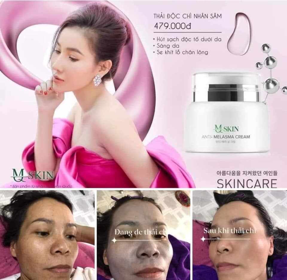 [HCM]KEM THẢI ĐỘC CHÌ NHÂN SÂM MQ SKIN