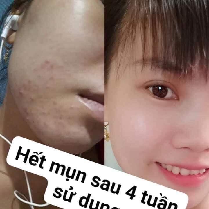 cao tinh nghệ sữa ong chúa  Thảo mộc 37