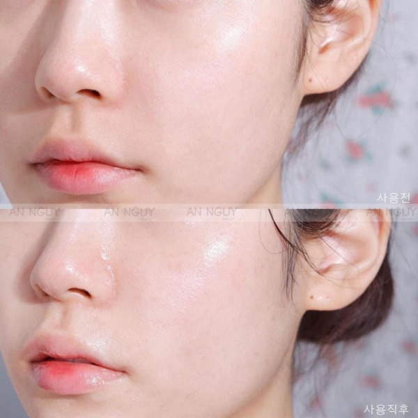 Mặt Nạ Mediheal Essential Mask