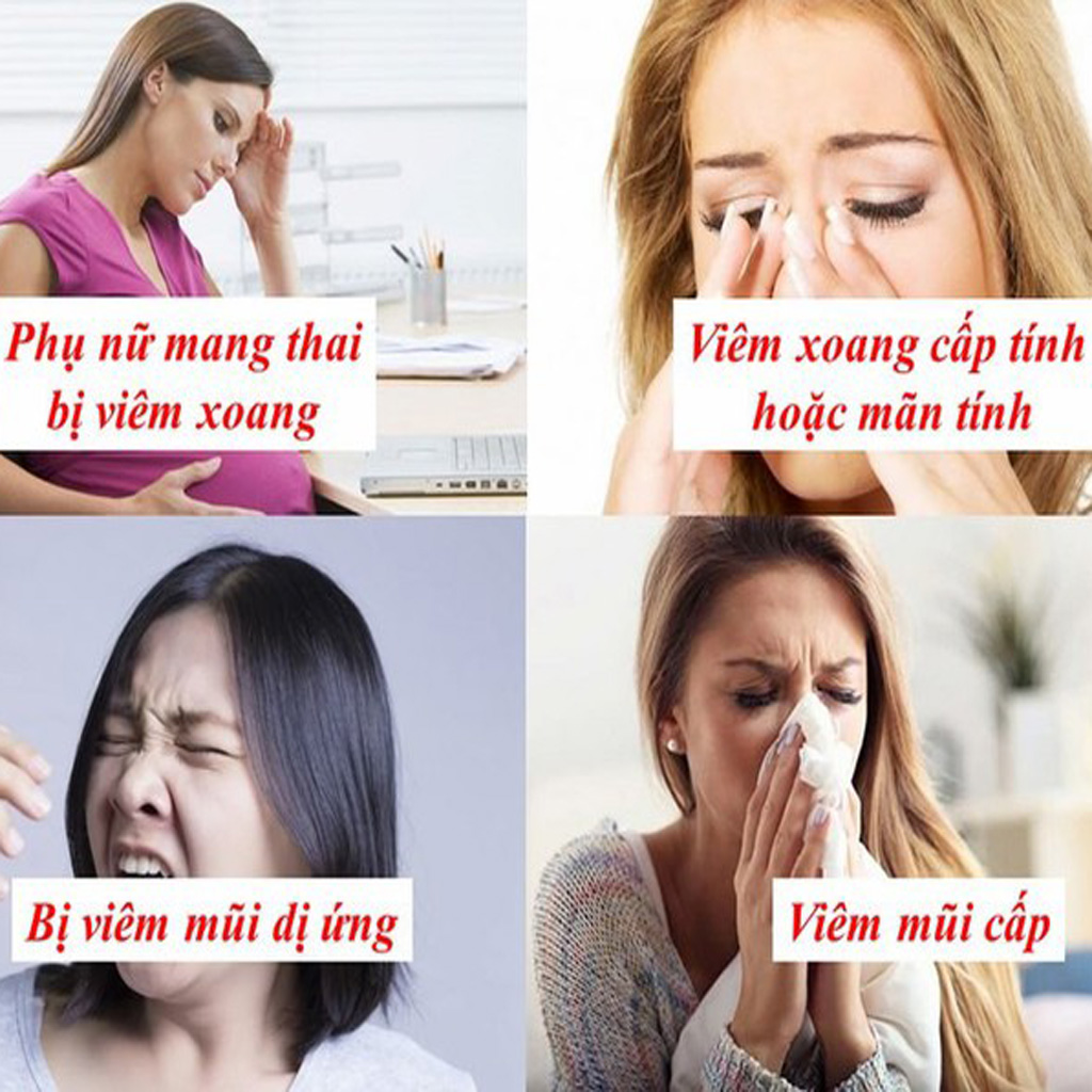 Thuốc Chữa Viêm Xoang Nam Hoàng