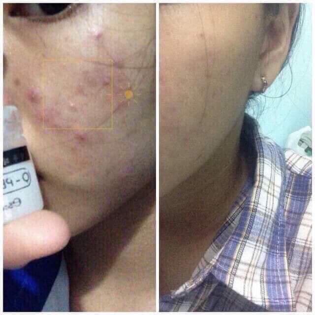 Serum jiuhe Hàn quốc