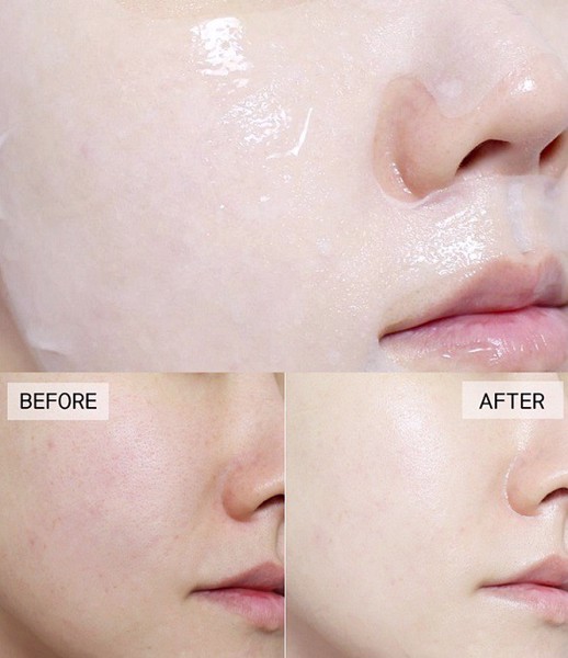 Mặt nạ chăm sóc da Mediheal Essential Mask REX-Đủ loại