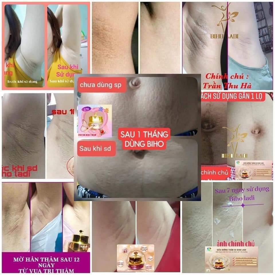 Kem Biho Ladi 5s (Hàng Chính Hãng )