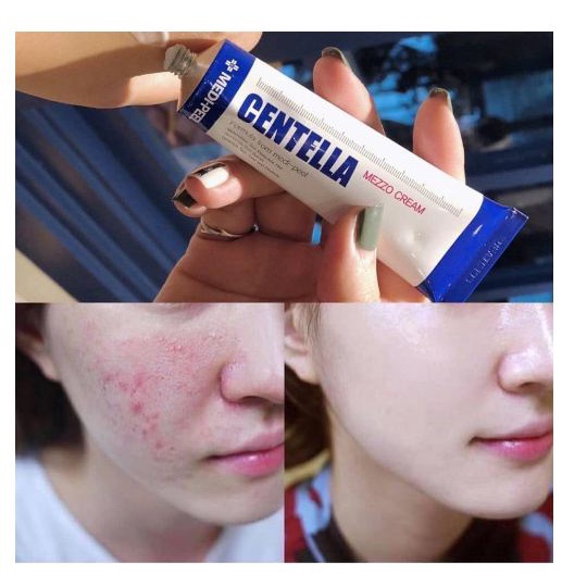 [HCM][Chính hãng] Kem MEDI PEEL Centella Mezzo Cream