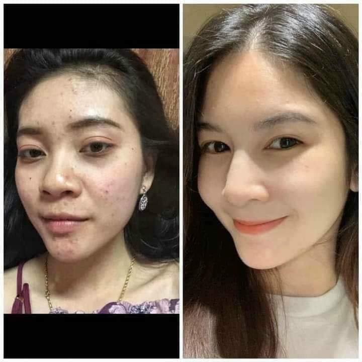 [HCM]Đông Y Gia Truyền Thảo Mộc Linh
