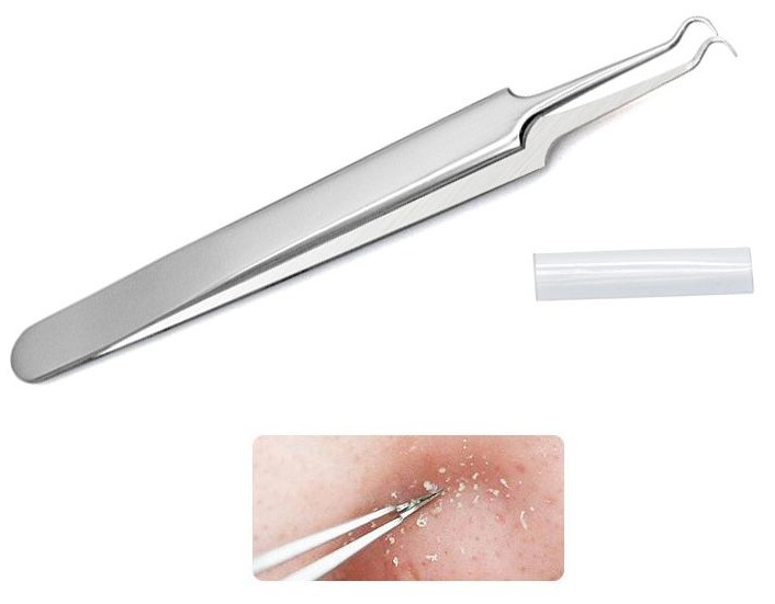 Nhíp Gấp Lấy Mụn Thần Thánh