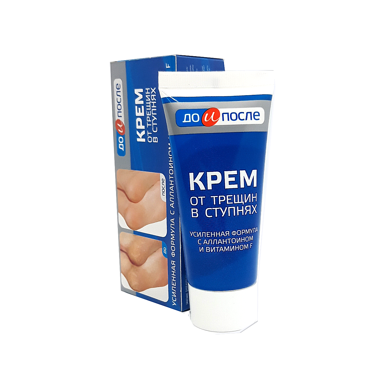 [ Hàng Chính Hãng] Kem Nứt Gót Chân Kpem Nga 50ml