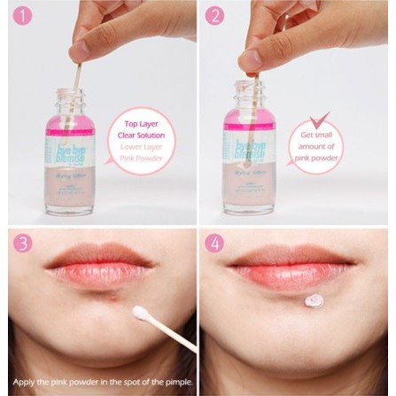 [HCM]Bye Bye Blemish For Acne Drying Lotion Giảm Mụn