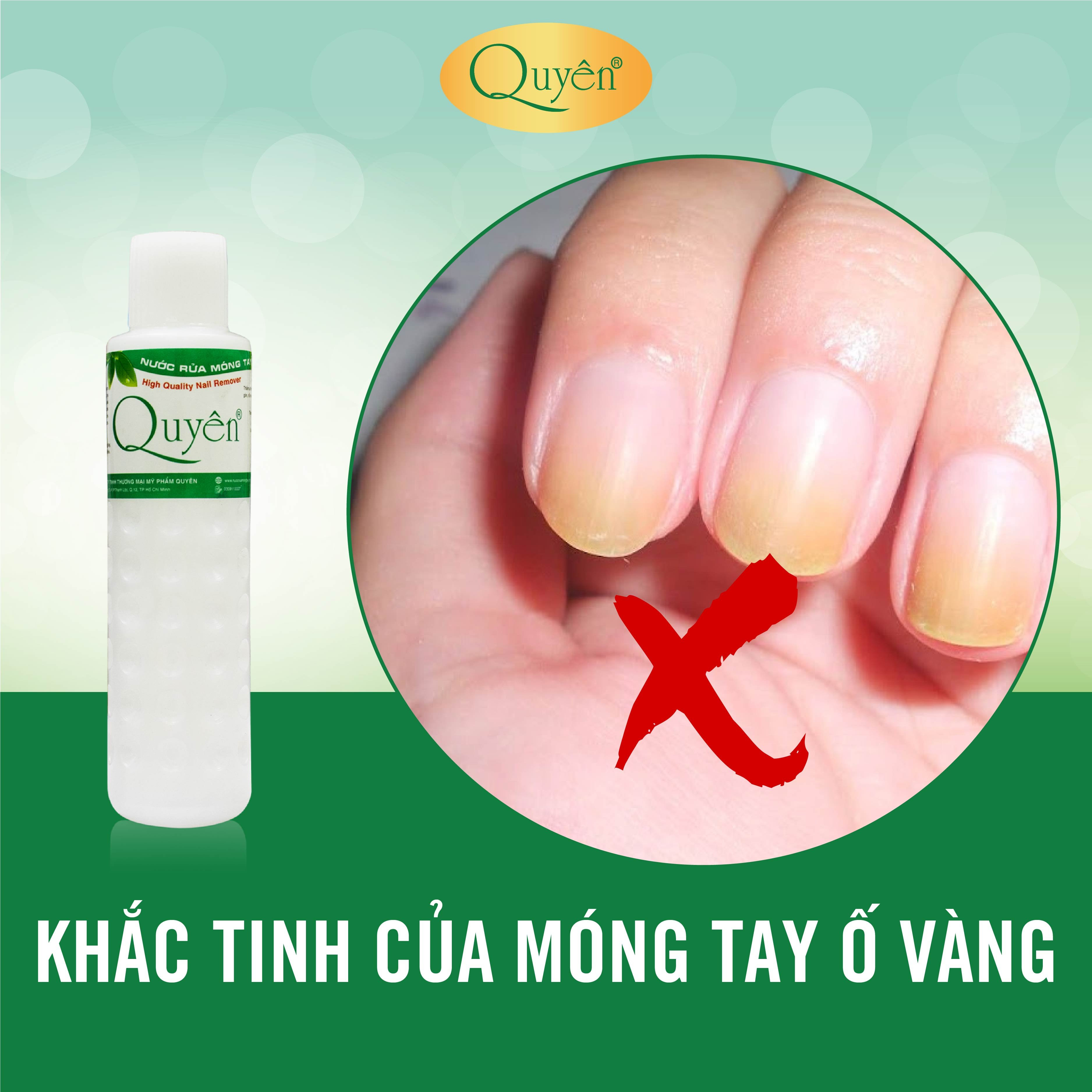 Nước Rửa Móng Tay Quyên Acetone loại A