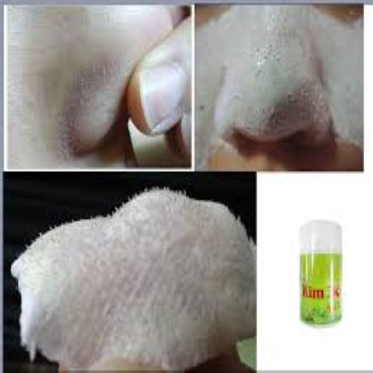 [HCM]Gel hút mụn Nha Đam Kim Đô 25g