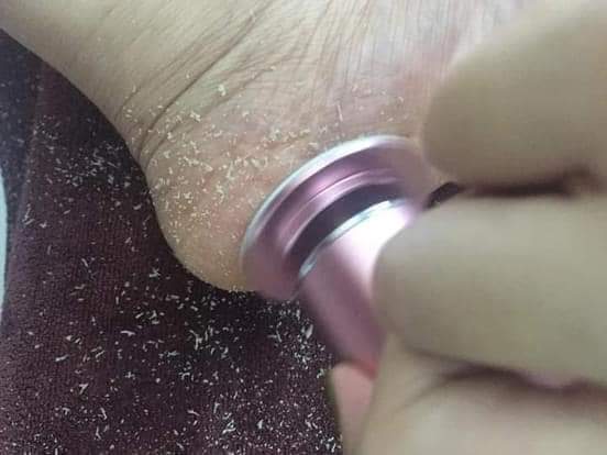 máy chà gót chân tẩy tế bào da chết chuyên dụng