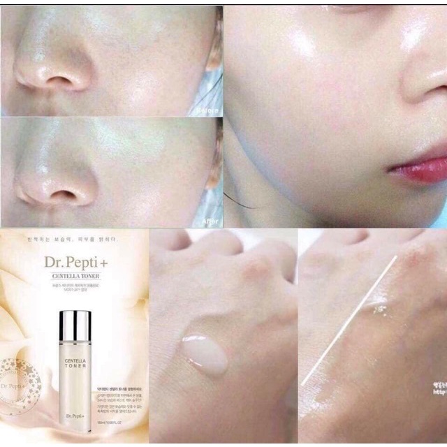 MẪU MỚI - Toner Giúp Căng Bóng Da Centella Toner EX- Dr.Pepti